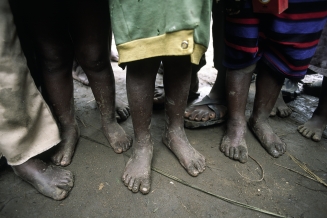 barefoot-african-children
